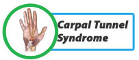 Carpal-Tunnel-Syndrome